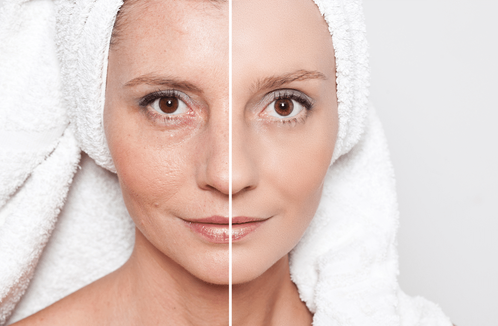Effortless Youthful Glow: Skin Tightening Facials Nearby post thumbnail image